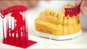 3D-Drucker für Dental- und Zahntechnik